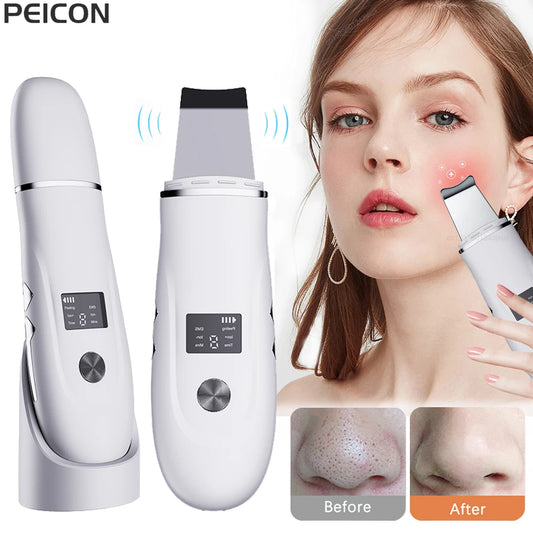 Ultrasonic Face Scrubber Facial Peeling Skin Deep Facial Cleaning